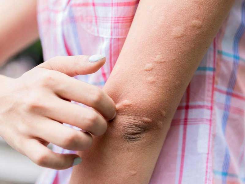 japanese_encephalitis